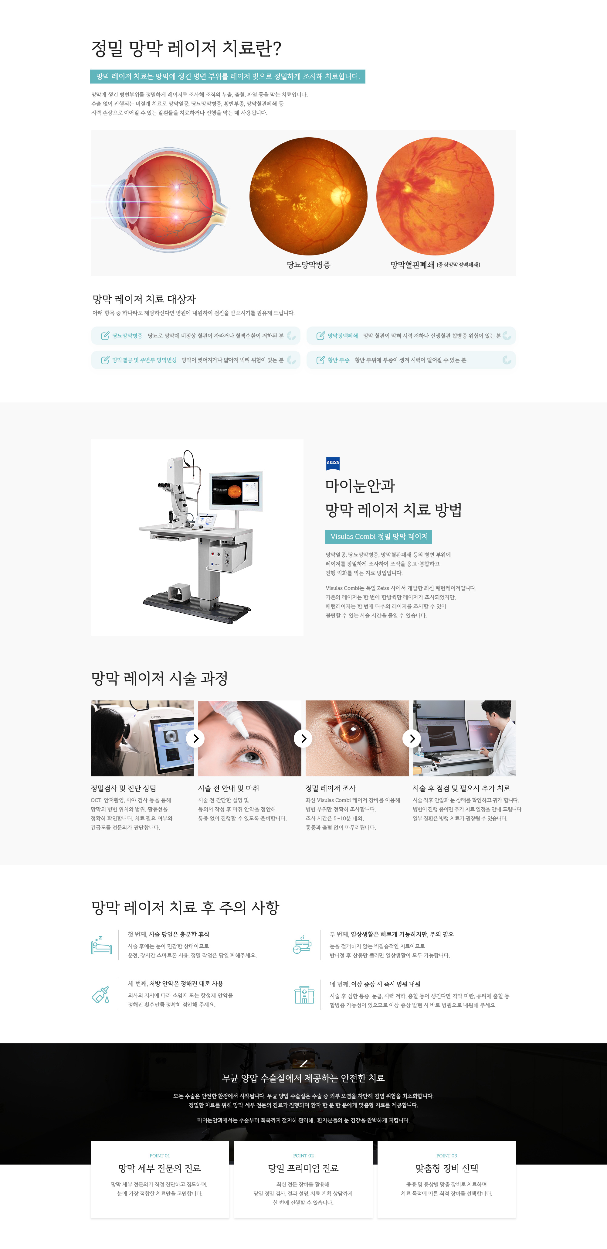 정밀 망막 레이저
