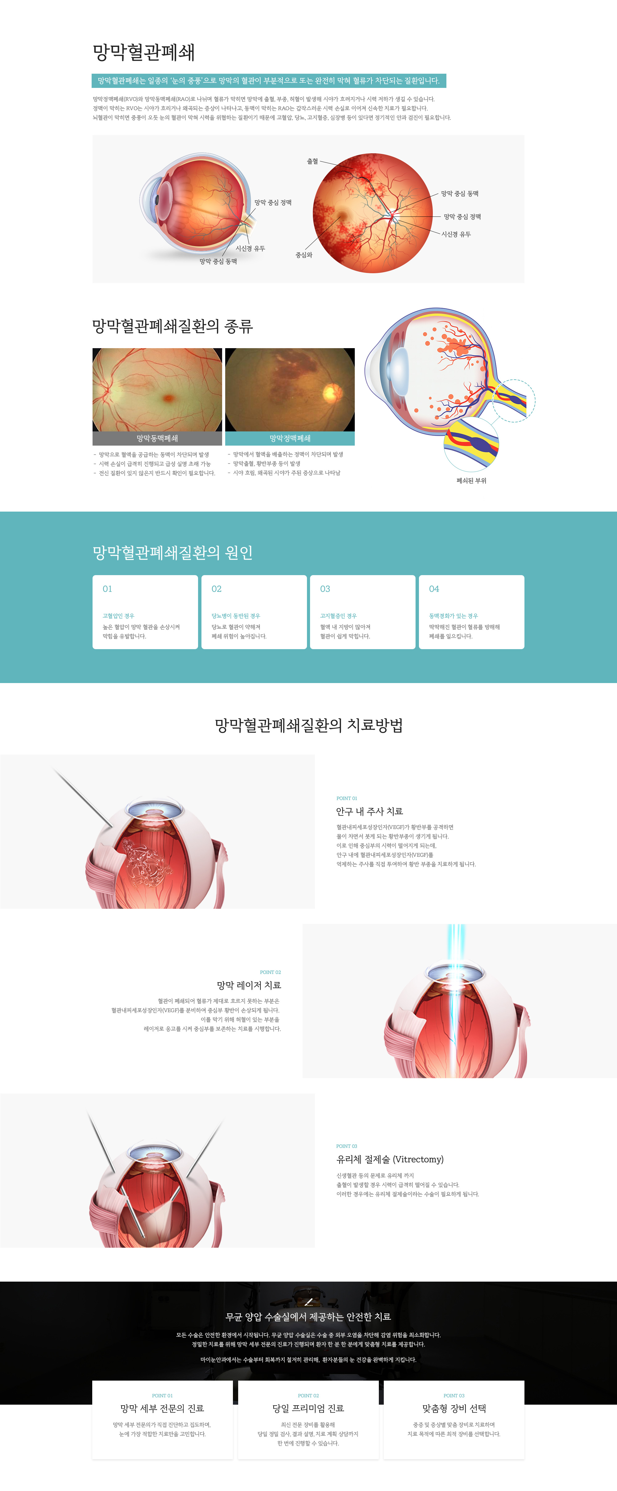망막혈관폐쇄